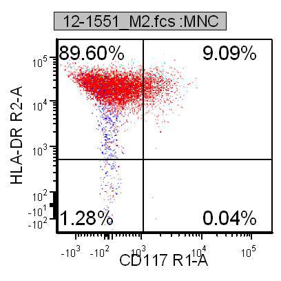 Figure 7f. Flow cytometry, Ethmoid sinus, HLA-DR bright